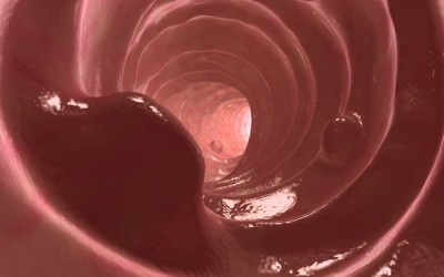 Prescient Medicine and Metabiomics Partner to Develop New Gastrointestinal Health Tests to Detect Polyps, Prevent Colon Cancer