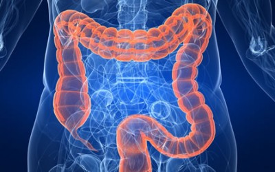 FDA Grants Breakthrough  Designation to the Prescient Metabiomics LifeKit® Prevent Test for the Early Detection of Colon Polyps and Colon Cancer